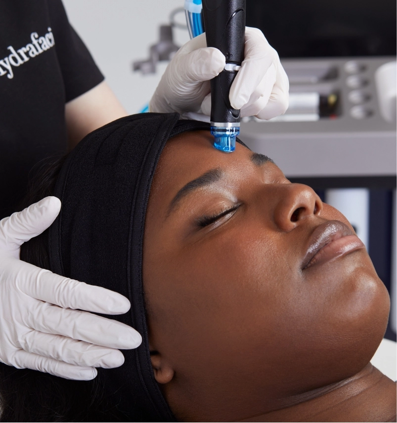 Ultimate HydraFacial Skin Renewal at Aurora Advanced Beauty Aesthetics